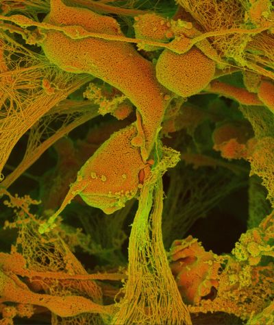onorato-spine-tacular_collagenous_cellular_embrace